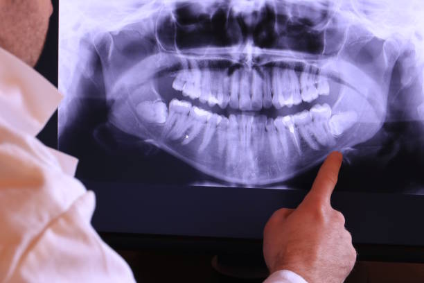 Best After-Hours Dental Trauma Care in Berly, MO