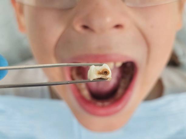 Best Same-Day Emergency Dental Services in Berly, MO